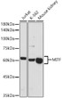 Western blot analysis of extracts of various cell lines, using MITF antibody (STJ24558) at 1:500 dilution. Secondary antibody: HRP Goat Anti-Rabbit IgG (H+L) (STJS000856) at 1:10000 dilution. Lysates/proteins: 25 Mu g per lane. Blocking buffer: 3% nonfat dry milk in TBST. Detection: ECL Basic Kit. Exposure time: 180s.