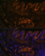 Immunofluorescence analysis of rat lung using MMP9 antibody (STJ24592) at dilution of 1:100. Blue: DAPI for nuclear staining.