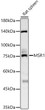 Western blot analysis of various lysates, using MSR1 rabbit polyclonal antibody (STJ24620) at 1:1000 dilution. Secondary antibody: HRP Goat Anti-rabbit IgG (H+L) (STJS000856) at 1:10000 dilution. Lysates/proteins: 25 Mu g per lane. Blocking buffer: 3% non-fat dry milk in TBST. Detection: ECL Basic Kit. Exposure time: 60s.