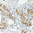 Immunohistochemistry analysis of MT2A in paraffin-embedded rat ovary using MT2A Rabbit polyclonal antibody (STJ24624) at dilution of 1:100 (40x lens). Perform high pressure antigen retrieval with 10 mM citrate buffer pH 6. 0 before commencing with immunohistochemistry staining protocol.