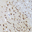 Immunohistochemistry analysis of MT2A in paraffin-embedded mouse spinal cord using MT2A Rabbit polyclonal antibody (STJ24624) at dilution of 1:100 (40x lens). Perform high pressure antigen retrieval with 10 mM citrate buffer pH 6. 0 before commencing with immunohistochemistry staining protocol.