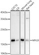 Western blot analysis of extracts of various cell lines, using MYL9 antibody (STJ24667) at 1:1000 dilution. Secondary antibody: HRP Goat Anti-Rabbit IgG (H+L) (STJS000856) at 1:10000 dilution. Lysates/proteins: 25 Mu g per lane. Blocking buffer: 3% nonfat dry milk in TBST. Detection: ECL Basic Kit. Exposure time: 90s.