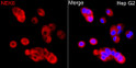 Immunofluorescence analysis of HepG2 cells using NEK8 Rabbit polyclonal antibody (STJ24736) at dilution of 1:500 (40x lens). Secondary antibody: Cy3 Goat Anti-Rabbit IgG (H+L) at 1:500 dilution. Blue: DAPI for nuclear staining.