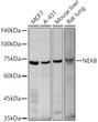 Western blot analysis of various lysates using NEK8 Rabbit polyclonal antibody (STJ24736) at 1:500 dilution. Secondary antibody:HRP Goat Anti-Rabbit IgG (H+L) (STJS000856) at 1:10000 dilution. Lysates/ proteins: 25 Mu g per lane. Blocking buffer: 3 % nonfat dry milk in TBST. Detection:ECL Basic Kit. Exposuretime: 180s.