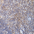 Immunohistochemistry analysis of paraffin-embedded mouse spleen using NFATC2 Rabbit polyclonal antibody (STJ24752) at dilution of 1:100 (40x lens). Perform high pressure antigen retrieval with 10 mM citrate buffer pH 6. 0 before commencing with immunohistochemistry staining protocol.