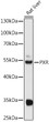 Western blot analysis of lysates from Rat liver, using PXR Rabbit pAb (STJ24811) at 1:1000 dilution. <br/>Secondary antibody: HRP-conjugated Goat anti-Rabbit IgG (H+L) (STJS000856) at 1:10000 dilution. <br/>Lysates/proteins: 25 Mu g per lane. <br/>Blocking buffer: 3% nonfat dry milk in TBST. <br/>Detection: ECL Basic Kit <br/>Exposure time: 60s.