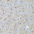 Immunohistochemistry analysis of NTF4 in paraffin-embedded rat brain using NTF4 Rabbit polyclonal antibody (STJ24831) at dilution of 1:100 (40x lens). Perform microwave antigen retrieval with 10 mM PBS buffer pH 7. 2 before commencing with immunohistochemistry staining protocol.
