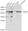 Western blot analysis of various lysates using PARD6A Rabbit polyclonal antibody (STJ24893) at 1:200 dilution. Secondary antibody: HRP Goat Anti-Rabbit IgG (H+L) (STJS000856) at 1:10000 dilution. Lysates/proteins: 25 Mu g per lane. Blocking buffer: 3% nonfat dry milk in TBST. Detection: ECL Basic Kit. Exposure time: 90s.