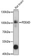 Western blot analysis of extracts of rat brain, using PDE4D antibody (STJ24933) at 1:1000 dilution. Secondary antibody: HRP Goat Anti-Rabbit IgG (H+L) (STJS000856) at 1:10000 dilution. Lysates/proteins: 25 Mu g per lane. Blocking buffer: 3% nonfat dry milk in TBST. Detection: ECL Basic Kit. Exposure time: 5s.