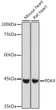 Western blot analysis of extracts of various cell lines, using PDK4 antibody (STJ24947) at 1:1000 dilution. Secondary antibody: HRP Goat Anti-Rabbit IgG (H+L) (STJS000856) at 1:10000 dilution. Lysates/proteins: 25 Mu g per lane. Blocking buffer: 3% nonfat dry milk in TBST. Detection: ECL Basic Kit. Exposure time: 1s.
