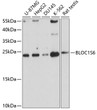 Western blot analysis of extracts of various cell lines, using BLOC1S6 antibody (STJ25026) at 1:1000 dilution. Secondary antibody: HRP Goat Anti-Rabbit IgG (H+L) (STJS000856) at 1:10000 dilution. Lysates/proteins: 25 Mu g per lane. Blocking buffer: 3% nonfat dry milk in TBST. Detection: ECL Basic Kit. Exposure time: 30s.