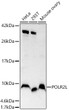 Western blot analysis of various lysates, using POLR2L rabbit polyclonal antibody (STJ25053) at 1:1000 dilution. Secondary antibody: HRP Goat Anti-rabbit IgG (H+L) (STJS000856) at 1:10000 dilution. Lysates/proteins: 25 Mu g per lane. Blocking buffer: 3% non-fat dry milk in TBST. Detection: ECL Basic Kit. Exposure time: 90s.