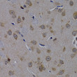 Immunohistochemistry analysis of paraffin-embedded rat brain using POLR2L antibody (STJ25053) at dilution of 1:200 (40x lens). Perform microwave antigen retrieval with 10 mM PBS buffer pH 7. 2 before commencing with immunohistochemistry staining protocol.