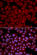 Immunofluorescence analysis of U2OS cells using PP1 beta antibody (STJ25081). Blue: DAPI for nuclear staining.