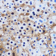 Immunohistochemistry analysis of paraffin-embedded Human liver using PP1 beta Rabbit polyclonal antibody (STJ25081) at dilution of 1:100 (40x lens). Perform microwave antigen retrieval with 10 mM PBS buffer pH 7. 2 before commencing with immunohistochemistry staining protocol.