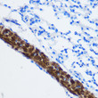 Immunohistochemistry analysis of paraffin-embedded Mouse lung using PP1 beta Rabbit polyclonal antibody (STJ25081) at dilution of 1:100 (40x lens). Perform microwave antigen retrieval with 10 mM PBS buffer pH 7. 2 before commencing with immunohistochemistry staining protocol.