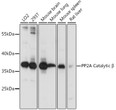 Western blot analysis of extracts of various cell lines, using PP2A Catalytic Beta antibody (STJ25086) at 1:1000 dilution. Secondary antibody: HRP Goat Anti-Rabbit IgG (H+L) (STJS000856) at 1:10000 dilution. Lysates/proteins: 25 Mu g per lane. Blocking buffer: 3% nonfat dry milk in TBST. Detection: ECL Basic Kit. Exposure time: 30s.