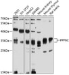 Western blot analysis of various lysates using PPP6C Rabbit pAb (STJ25097) at 1:1000 dilution. <br/>Secondary antibody: HRP-conjugated Goat anti-Rabbit IgG (H+L) (STJS000856) at 1:10000 dilution. <br/>Lysates/proteins: 25 Mu g per lane. <br/>Blocking buffer: 3% nonfat dry milk in TBST. <br/>Detection: ECL Enhanced Kit <br/>Exposure time: 90s.