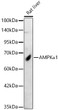 Western blot analysis of lysates from Rat liver, using AMPK Alpha 1 Rabbit polyclonal antibody (STJ25112) at 1:2000 dilution. Secondary antibody: HRP Goat Anti-Rabbit IgG (H+L) (STJS000856) at 1:10000 dilution. Lysates/proteins: 25ug per lane. Blocking buffer: 3% nonfat dry milk in TBST. Detection: ECL Basic Kit. Exposure time: 30s.