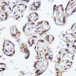 Immunohistochemistry analysis of paraffin-embedded human placenta using PRMT1 rabbit polyclonal antibody (STJ25146) at dilution of 1:150 (40x lens). Perform high pressure antigen retrieval with 10 mM citrate buffer pH 6. 0 before commencing with immunohistochemistry staining protocol.