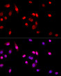 Immunofluorescence analysis of A-549 cells using PRMT1 rabbit polyclonal antibody (STJ25146) at dilution of 1:50 (40x lens). Blue: DAPI for nuclear staining.