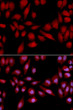 Immunofluorescence analysis of U2OS cells using PSMA2 Rabbit polyclonal antibody (STJ25171). Secondary antibody: Cy3 Goat Anti-Rabbit IgG (H+L) at 1:500 dilution. Blue: DAPI for nuclear staining.