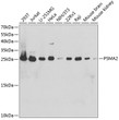 Western blot analysis of various lysates using PSMA2 Rabbit polyclonal antibody (STJ25171) at 1:1000 dilution. Secondary antibody: HRP Goat Anti-Rabbit IgG (H+L) (STJS000856) at 1:10000 dilution. Lysates/proteins: 25 Mu g per lane. Blocking buffer: 3% nonfat dry milk in TBST.