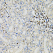 Immunohistochemistry analysis of paraffin-embedded rat kidney using PSMC3 Antibody (STJ25182) at dilution of 1:100 (40x lens). Perform microwave antigen retrieval with 10 mM PBS buffer pH 7. 2 before commencing with immunohistochemistry staining protocol. Immunohistochemistry analysis of paraffin-embedded rat kidney using PSMC3 Antibody (STJ25182) at dilution of 1:100 (40x lens). Perform microwave antigen retrieval with 10 mM PBS buffer pH 7. 2 before commencing with immunohistochemistry staining protocol.