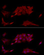 Immunofluorescence analysis of NIH/3T3 cells using [KO Validated] PTPN2 Rabbit polyclonal antibody (STJ25225) at dilution of 1:200 (40x lens). Secondary antibody: Cy3 Goat Anti-Rabbit IgG (H+L) at 1:500 dilution. Blue: DAPI for nuclear staining.