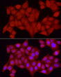 Immunofluorescence analysis of HeLa cells using [KO Validated] PTPN2 Rabbit polyclonal antibody (STJ25225) at dilution of 1:200 (40x lens). Secondary antibody: Cy3 Goat Anti-Rabbit IgG (H+L) at 1:500 dilution. Blue: DAPI for nuclear staining.