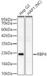 Western blot analysis of various lysates, using RBP4 Rabbit polyclonal antibody (STJ25317) at 1:300 dilution. Secondary antibody: HRP Goat Anti-Rabbit IgG (H+L) (STJS000856) at 1:10000 dilution. Lysates/proteins: 25ug per lane. Blocking buffer: 3% nonfat dry milk in TBST. Detection: ECL Basic Kit. Negative control (NC) :HAP1Exposure time: 30s.