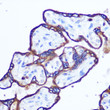 Immunohistochemistry analysis of paraffin-embedded human placenta using RhoA rabbit polyclonal antibody (STJ25351) at dilution of 1:100 (40x lens). Perform microwave antigen retrieval with 10 mM Tris/EDTA buffer pH 9. 0 before commencing with immunohistochemistry staining protocol.