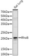 Western blot analysis of extracts of Rat lung, using RhoB rabbit polyclonal antibody antibody (STJ25353) at 1:1000 dilution. Secondary antibody: HRP Goat Anti-rabbit IgG (H+L) (STJS000856) at 1:10000 dilution. Lysates/proteins: 25 Mu g per lane. Blocking buffer: 3% non-fat dry milk in TBST. Detection: ECL Basic Kit. Exposure time: 3s.