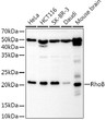 Western blot analysis of extracts of various cell lines, using RhoB rabbit polyclonal antibody antibody (STJ25353) at 1:1000 dilution. Secondary antibody: HRP Goat Anti-rabbit IgG (H+L) (STJS000856) at 1:10000 dilution. Lysates/proteins: 25 Mu g per lane. Blocking buffer: 3% non-fat dry milk in TBST. Detection: ECL Basic Kit. Exposure time: 10s.