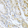 Immunohistochemistry analysis of paraffin-embedded human stomach using RNASE13 antibody (STJ25364) at dilution of 1:100 (40x lens). Perform microwave antigen retrieval with 10 mM PBS buffer pH 7. 2 before commencing with immunohistochemistry staining protocol.