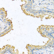 Immunohistochemistry analysis of paraffin-embedded human prostate using RNASE13 antibody (STJ25364) at dilution of 1:100 (40x lens). Perform microwave antigen retrieval with 10 mM PBS buffer pH 7. 2 before commencing with immunohistochemistry staining protocol.