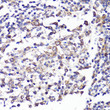 Immunohistochemistry analysis of paraffin-embedded human tonsil using CD62L/L-Selectin antibody (STJ25469) at dilution of 1:100 (40x lens). Perform microwave antigen retrieval with 10 mM PBS buffer pH 7. 2 before commencing with immunohistochemistry staining protocol.