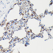 Immunohistochemistry analysis of paraffin-embedded rat lung using SFTPA1 Rabbit polyclonal antibody (STJ25508) at dilution of 1:50 (40x lens). Perform high pressure antigen retrieval with 10 mM citrate buffer pH 6. 0 before commencing with immunohistochemistry staining protocol.