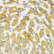 Immunohistochemistry analysis of paraffin-embedded human liver using SLC27A2 antibody (STJ25573) at dilution of 1:100 (40x lens). Perform microwave antigen retrieval with 10 mM PBS buffer pH 7. 2 before commencing with immunohistochemistry staining protocol.