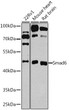 Western blot analysis of extracts of various cell lines, using Smad6 antibody (STJ25610) at 1:1000 dilution. Secondary antibody: HRP Goat Anti-Rabbit IgG (H+L) (STJS000856) at 1:10000 dilution. Lysates/proteins: 25 Mu g per lane. Blocking buffer: 3% nonfat dry milk in TBST. Detection: ECL Basic Kit. Exposure time: 15s.