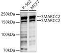 Western blot analysis of various lysates, using SMARCC2 Rabbit polyclonal antibody (STJ25617) at 1:500 dilution. Secondary antibody: HRP Goat Anti-Rabbit IgG (H+L) (STJS000856) at 1:10000 dilution. Lysates/proteins: 25ug per lane. Blocking buffer: 3% nonfat dry milk in TBST. Detection: ECL Basic Kit. Exposure time: 60s.