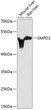 Western blot analysis of various lysates using SMPD2 Rabbit polyclonal antibody (STJ25629) at 1:3000 dilution. Secondary antibody: HRP Goat Anti-Rabbit IgG (H+L) (STJS000856) at 1:10000 dilution. Lysates/proteins: 25 Mu g per lane. Blocking buffer: 3% nonfat dry milk in TBST. Detection: ECL Basic Kit. Exposure time: 90s.