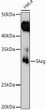 Western blot analysis of lysates from HeLa cells, using Slug Rabbit polyclonal antibody (STJ25635) at 1:1000 dilution. Secondary antibody: HRP Goat Anti-Rabbit IgG (H+L) (STJS000856) at 1:10000 dilution. Lysates/proteins: 25 Mu g per lane. Blocking buffer: 3% nonfat dry milk in TBST. Detection: ECL Enhanced Kit. Exposure time: 180s.