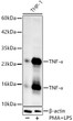 Western blot analysis of THP-1, using TNF-Alpha rabbit polyclonal antibody (STJ25882) at 1:1000 dilution. THP-1 cells were treated by PMA/TPA (80 nM) at 37 °C for overnight and LPS (1 Mu g/ml) at 37 °C for 6 hours. Secondary antibody: HRP Goat Anti-rabbit IgG (H+L) (STJS000856) at 1:10000 dilution. Lysates/proteins: 25ug per lane. Blocking buffer: 3% non-fat dry milk in TBST. Detection: ECL Enhanced Kit. Exposure time: 60s.