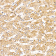Immunohistochemistry analysis of paraffin-embedded Human liver using TNK2 Rabbit pAb (STJ25905) at dilution of 1:50 (40x lens). High pressure antigen retrieval performed with 0. 01M Citrate Bufferr (pH 6. 0) prior to immunohistochemistry staining.