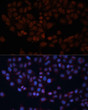 Immunofluorescence analysis of HeLa cells using TOM70 antibody (STJ25915) at dilution of 1:100. Blue: DAPI for nuclear staining.