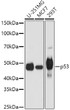 Western blot analysis of various lysates using p53 Rabbit polyclonal antibody (STJ25927) at 1:1000 dilution. Secondary antibody: HRP Goat Anti-Rabbit IgG (H+L) (STJS000856) at 1:10000 dilution. Lysates/proteins: 25 Mu g per lane. Blocking buffer: 3% nonfat dry milk in TBST. Detection: ECL Basic Kit. Exposure time: 10s.