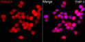 Immunofluorescence analysis of THP-1 cells using TRIM21/SS-A rabbit polyclonal antibody (STJ25964) at dilution of 1:100 (40x lens). Secondary antibody: Cy3 Goat Anti-rabbit IgG (H+L) at 1:500 dilution. Blue: DAPI for nuclear staining.