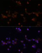 Immunofluorescence analysis of NIH-3T3 cells using UBE2L3 Polyclonal Antibody (STJ26020) at dilution of 1:100 (40x lens). Blue: DAPI for nuclear staining.