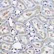Immunohistochemistry analysis of paraffin-embedded rat kidney using UBE2L3 Rabbit polyclonal antibody (STJ26020) at dilution of 1:100 (40x lens). Perform high pressure antigen retrieval with 10 mM citrate buffer pH 6. 0 before commencing with immunohistochemistry staining protocol.